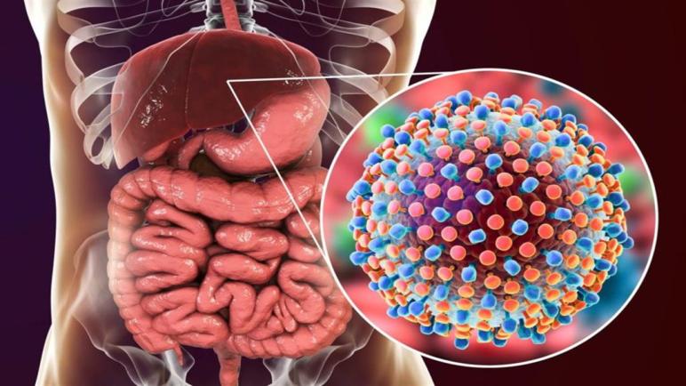 عدوى التهاب الكبد. منظمة الصحة العالمية تدق ناقوس الخطر